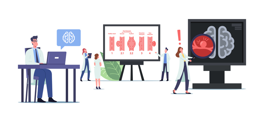 Tiny Doctors Characters at Huge Infographics with Aneurysm Phases. Disease of Artery Wall Weakening That Create Bulge, Distention of Artery, Brain Stroke, Apoplexy. Cartoon People Vector Illustration
